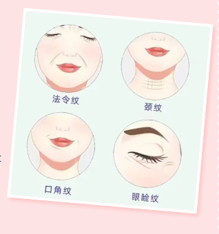 靜態(tài)紋情況.png