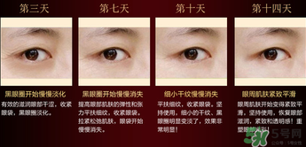奧蓓斯眼霜怎么用？奧蓓斯眼霜使用方法