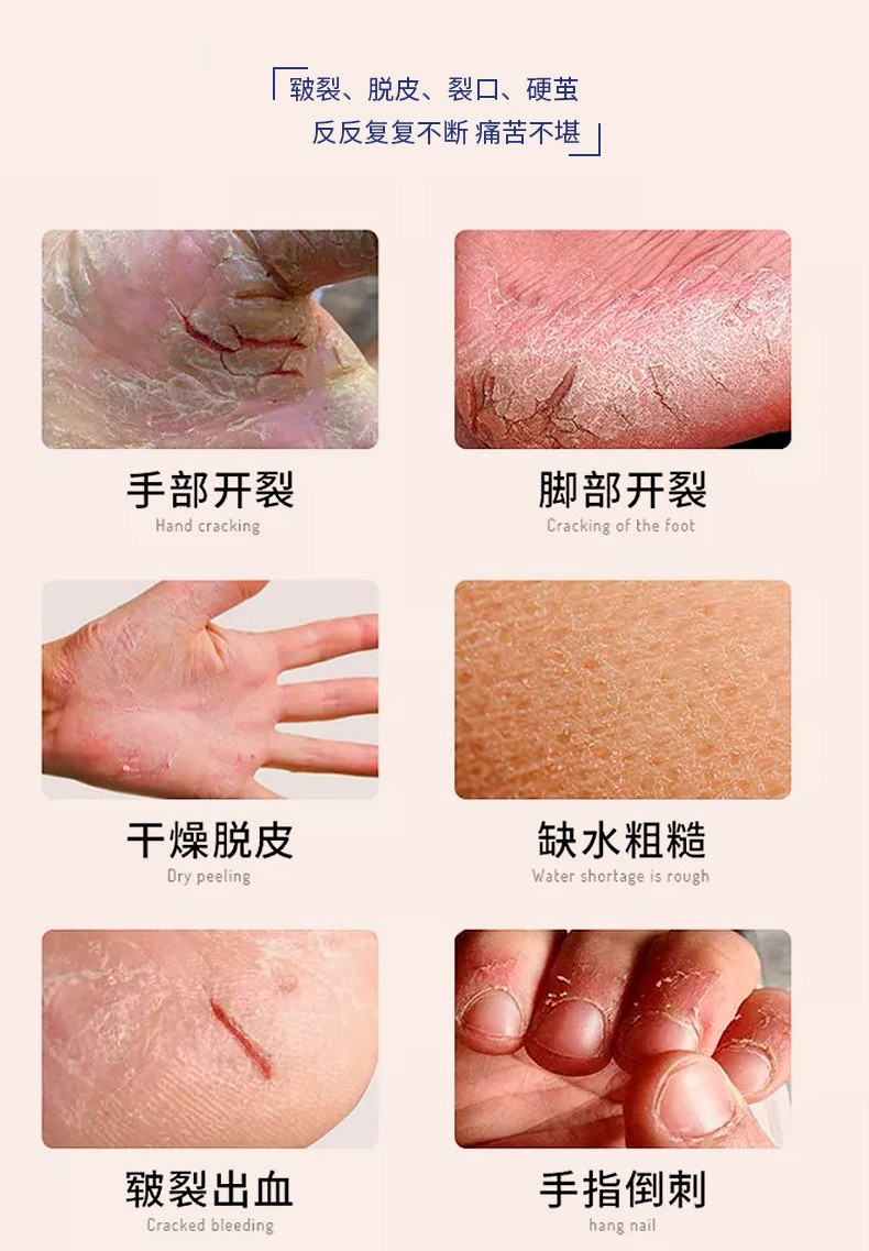 防裂護足裂可寧霜50g護手霜_03.jpg